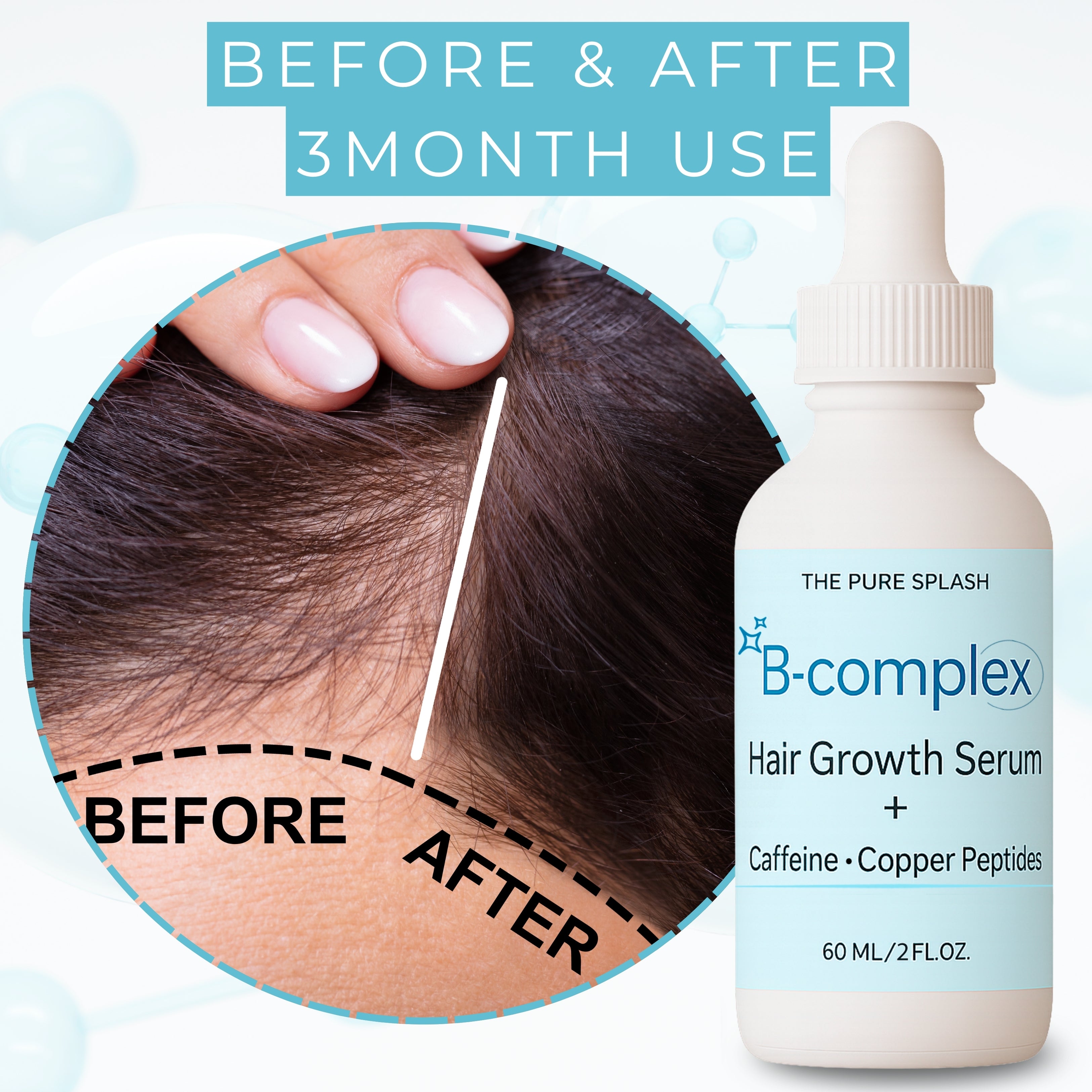 Vitamin B Complex Hair & Scalp Care Serum – Daily Nutrients with Caffeine & Copper Complex – Nourishes & Strengthens Hair – Lightweight, Non-Greasy Formula